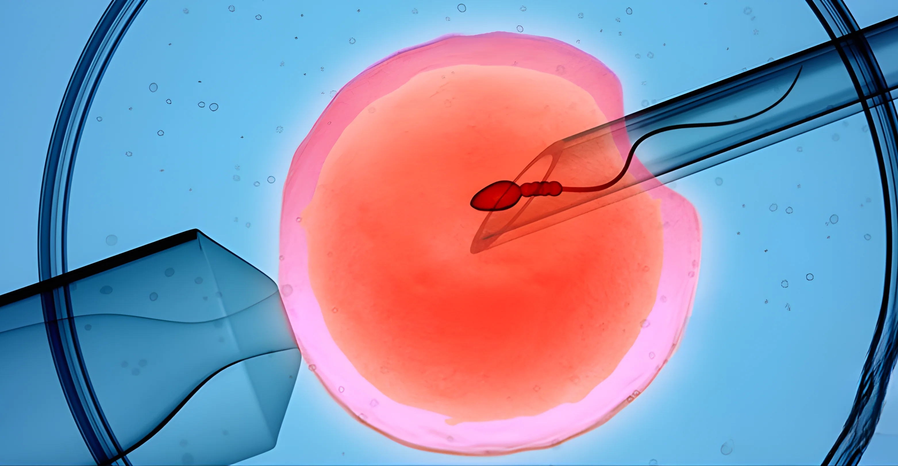 Best Fertility clinic in hyderabad IVF & ICSI Treatment
